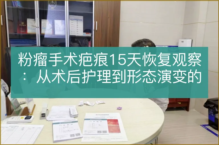 粉瘤手术疤痕15天恢复观察:从术后护理到形态演变的专业解析